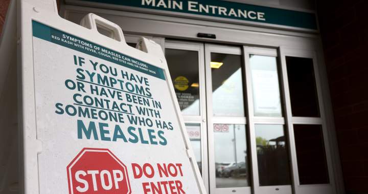 Įspėjimas nuo tymų ragina šalis daugiau skiepytis, įskaitant Kanadą – nacionalinis